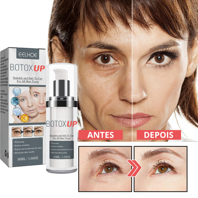 Botox-UP Sérum Anti-idade / O segredo das Blogueiras - PROMOÇÃO NESSE FIM DE SEMANA!