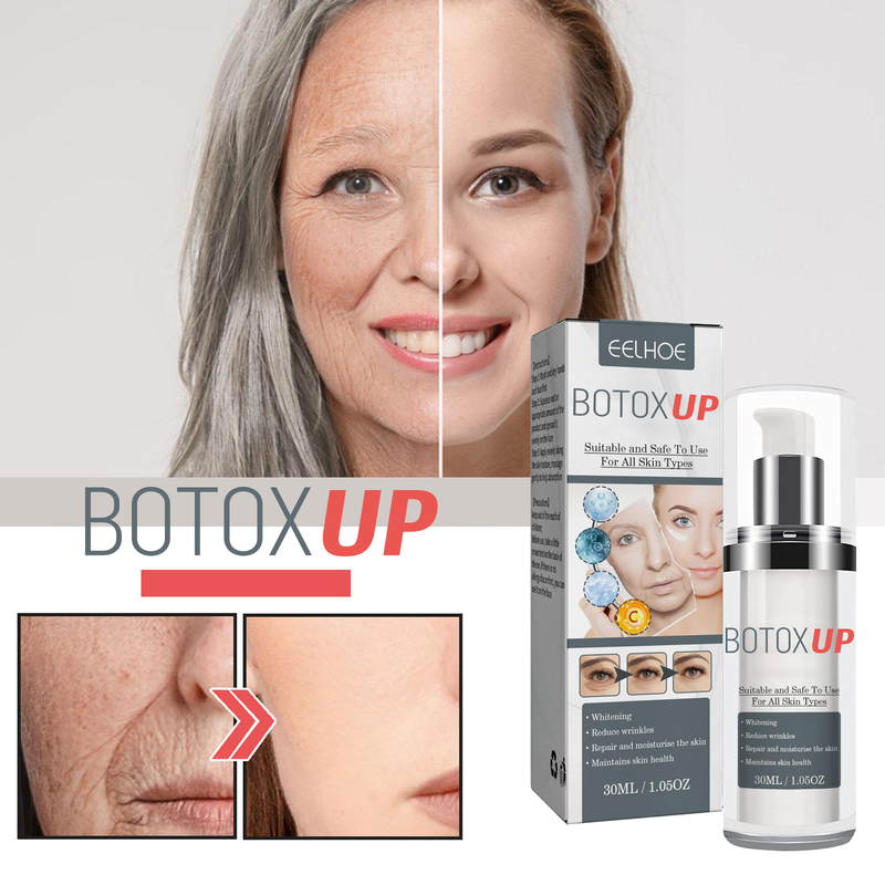 Botox-UP Sérum Anti-idade / O segredo das Blogueiras - PROMOÇÃO NESSE FIM DE SEMANA!