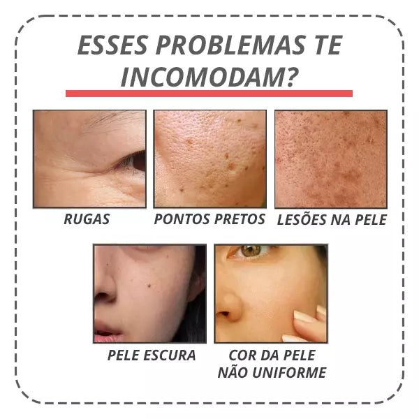 Botox-UP Sérum Anti-idade / O segredo das Blogueiras - PROMOÇÃO NESSE FIM DE SEMANA!