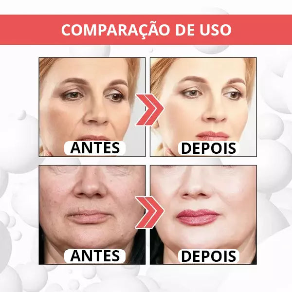 Botox-UP Sérum Anti-idade / O segredo das Blogueiras - PROMOÇÃO NESSE FIM DE SEMANA!