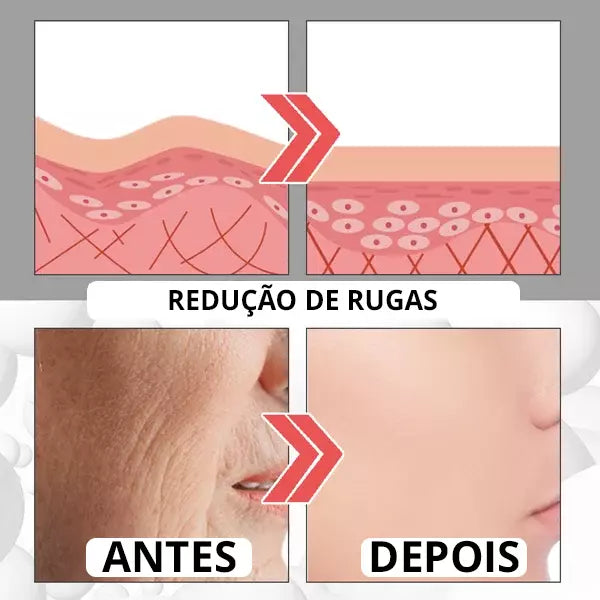 Botox-UP Sérum Anti-idade / O segredo das Blogueiras - PROMOÇÃO NESSE FIM DE SEMANA!